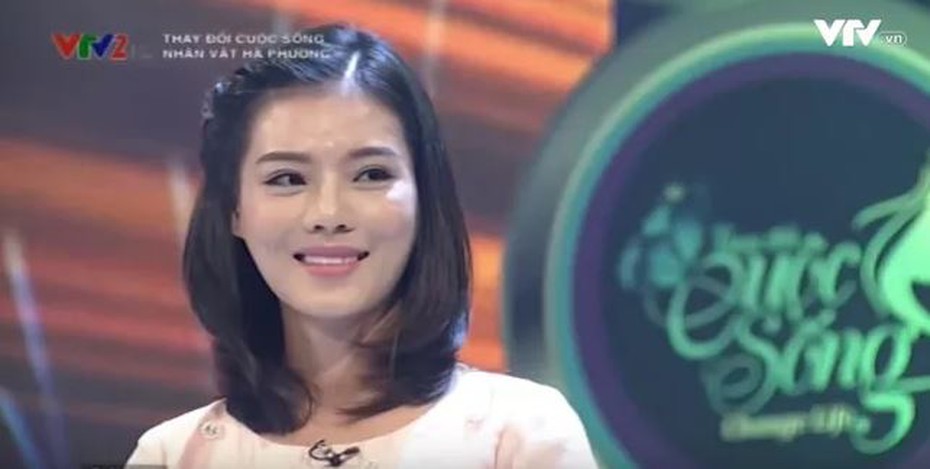 Ngoại hình xấu xí, cô gái 26 tuổi lột xác 'hóa thiên nga'