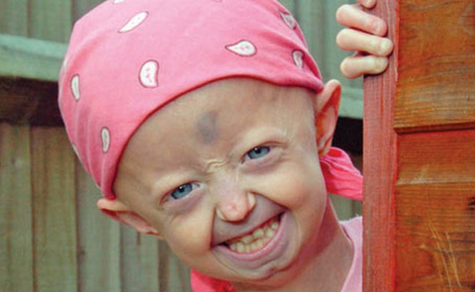 Xót xa bé gái 13 tuổi trong hình hài bà lão