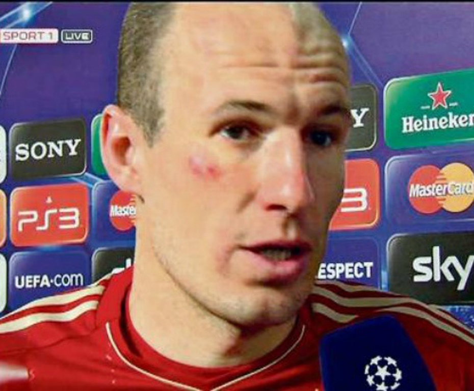 Đấm Robben bầm mặt, Ribery bị phạt khoản tiền lớn