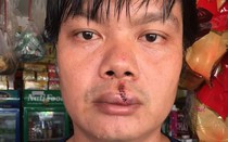 Khởi tố vụ người tố cáo doanh nghiệp gây ô nhiễm bị đánh ‘bầm dập’