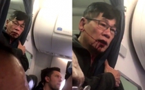 Bê bối United Airlines: Bác sĩ gốc Việt thuê 2 luật sư Mỹ nổi tiếng