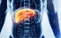 Biến chứng của viêm gan siêu vi B làm nhiều người chết hơn cả HIV?