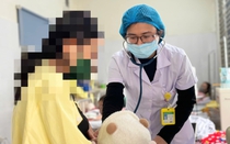 Hồi sức đặc biệt duy trì sự sống cho bé 5 tháng tuổi mắc bệnh sởi