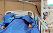 4 người trong một nhà nhập viện cấp cứu sau khi ăn trứng muối