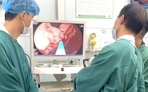 Chủ quan với cơn đau bụng, người đàn ông suýt đánh đổi bằng mạng sống