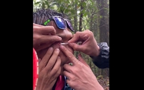 Mắt người đàn ông đau dữ dội, bạn bè lấy ra thứ "đáng sợ"