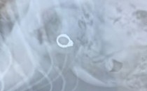 Chụp X-quang, bác sĩ phát hiện ra "bí mật" trong bụng chú chó