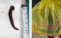 Người đàn ông gặp tai nạn hi hữu khi đang làm việc ngoài đồng