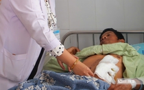 Giành lại sự sống cho bệnh nhân vỡ tá tràng trong đêm