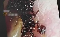 Bé gái 2 tuổi đi khám vì đau tai, bác sĩ phát hiện "bí mật đáng sợ"