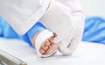 Khám chân cho người đàn ông 45 tuổi, bác sĩ sốc nặng khi phát hiện "bí mật đáng sợ"