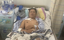 Làm rõ vụ "hiệp sĩ" ở Bình Dương bị đối tượng trộm xe máy tấn công