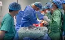 Kỳ tích cứu sống bệnh nhân xuất huyết tiêu hóa rò động mạch hiếm gặp