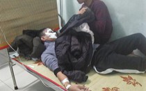 Dùng bật lửa đốt xăng, nam sinh 16 tuổi bị bỏng 2 mắt