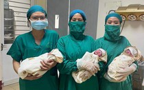 Phẫu thuật thành công cho sản phụ mang thai ba cùng trứng hiếm gặp