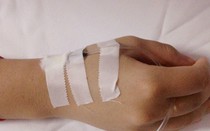 Bệnh nhân bất ngờ tử vong chưa rõ nguyên nhân sau khi vào viện điều trị sốt virus