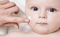 Cách nhận biết bệnh viêm da dị ứng và phương pháp điều trị