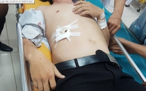Vụ học sinh đâm thầy giáo trọng thương: Đại diện sở GD&ĐT "đau lòng"