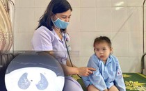 Bé trai 3 tuổi ho liên tục, khó thở vì nút bấm điều khiển nằm trong khí quản
