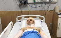 Phía Akira Phan chia sẻ lý do nam ca sĩ quyết định phẫu thuật hút mỡ, tạo cơ bụng