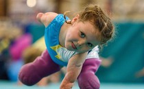 Soup sáng: Bé gái bị mất tứ chi khiến cả thế giới khâm phục vì nghị lực của mình