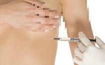 Nhắm mắt, liều mạng tiêm Filler làm đẹp vòng 1, vòng 3