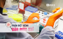 Info: Phân biệt bệnh đậu mùa khỉ với thủy đậu, tay chân miệng