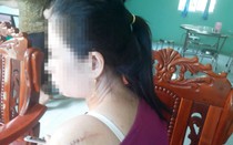 Sức khỏe các nạn nhân trong vụ cô dâu bị chồng cũ chém trong ngày cưới giờ ra sao?