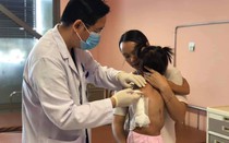 Phẫu thuật thành công cho bệnh nhi 2 tuổi có khối u mỡ 4kg