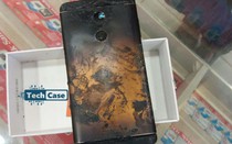 Xiaomi Redmi Note 4 nổ cháy đùi người dùng