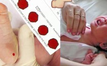 Bác sĩ sản khoa giải thích vì sao phải lấy máu gót chân trẻ sơ sinh