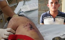 Chủ quán cà phê kích dục đánh tiếp viên nhập viện: Cần làm rõ tội môi giới mại dâm