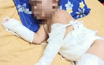 Tạm giữ nhóm người ném xăng phóng hỏa ki-ốt khiến 2 bé trai bỏng nặng