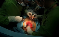 Cứu sống nam thanh niên ngưng tim nghi bị người yêu đâm