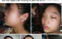 Mới sinh con hơn 1 tháng, vợ 16 tuổi lên mạng xã hội tố bị chồng bạo hành