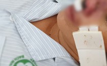 Sự thật sau tin đồn Quảng Bình xuất hiện “vi khuẩn ăn thịt người”