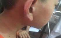 Nghệ An: Công an triệu tập mẹ kế nghi bạo hành con chồng