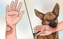 Bình Thuận: Một ca tử vong nghi do bệnh dại ở huyện Hàm Thuận Nam