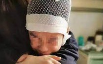 Giáo viên bạo hành học sinh tụ máu não vì nói chuyện trong lớp