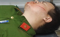 Đà Nẵng: Hai công an bị chém khi khống chế đối tượng dọa giết người