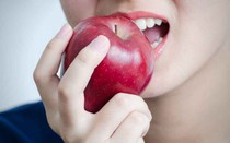 Những loại quả quen thuộc giá rẻ nhưng lại là "bảng vàng" chống ung thư