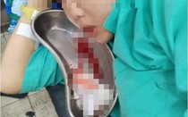 Chuyện về bé trai 35 tuần tuổi chào đời khi mẹ ung thư