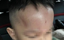 Đà Nẵng: Cơ quan chức năng xác minh vụ việc phụ huynh phản ánh trẻ bị bạo hành