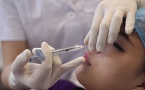 Tiêm chất filler nâng mũi, cô gái bị đột quỵ và mù một mắt