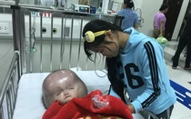 Thực hư thông tin mẹ trục lợi qua bệnh não úng thủy của con nhỏ