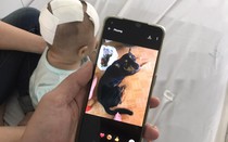 Cấp cứu kịp thời bé gái bị thú cưng cắn xuyên sọ