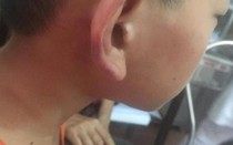 Xác minh vụ con riêng nghi bị mẹ kế hành hung phải nhập viện