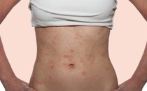 Sự thật về các loại hình giảm cân cấp tốc