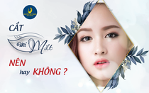 Cắt mí mắt nên hay không?