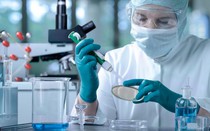 Cấy tế bào gốc: Liệu pháp mới trong quá trình điều trị ung thư
